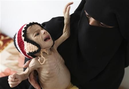 الأمم المتحدة: مخاوف من مجاعة محتملة سيشهدها اليمن العام 2017