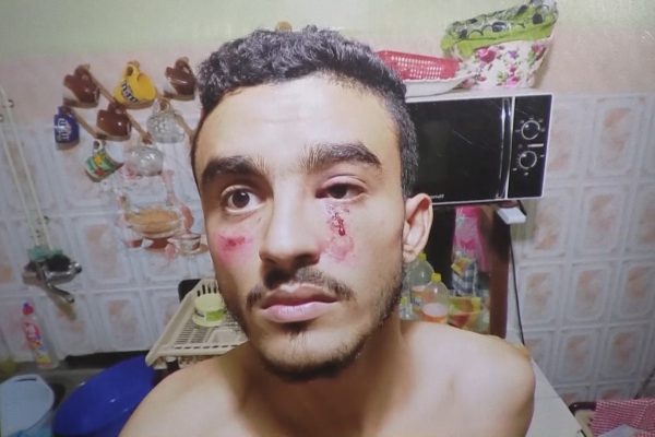 البليدة: مدير ثانوية الشهيد زروق الوناس بمفتاح يعتدي بالضرب على تلميذ