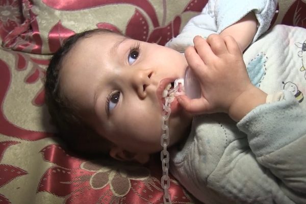 مأساة الطفل محمد… لم يحدد جنسه ذكرا أو أنثى إلا بعد شهرين من ولادته