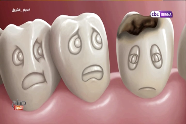 ما مدى تأثير البكتيريا على صحة الأسنان؟!