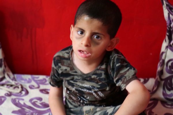 الطفل عبد الجليل من ذوي الاحتياجات الخاصة يحتاج 800 دج يوميا للمشي