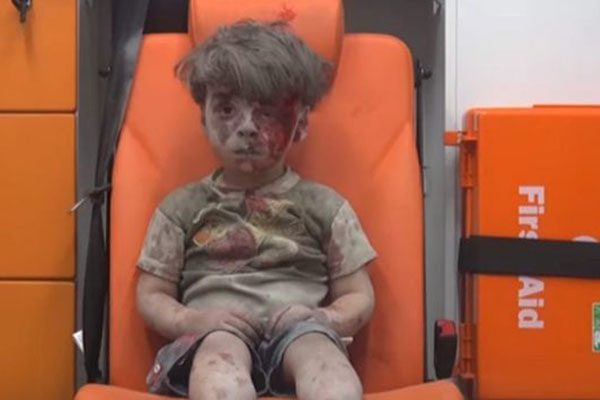 الحدث: عمران طفل سوري “صدم العالم” بصمته !