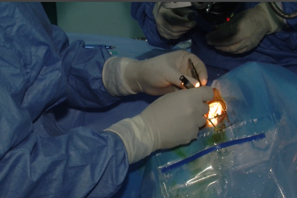 أطباء مستشفى بني مسوس بالعاصمة يجرون عمليات في جراحة العيون بمستشفى ابن سينا بأدرار